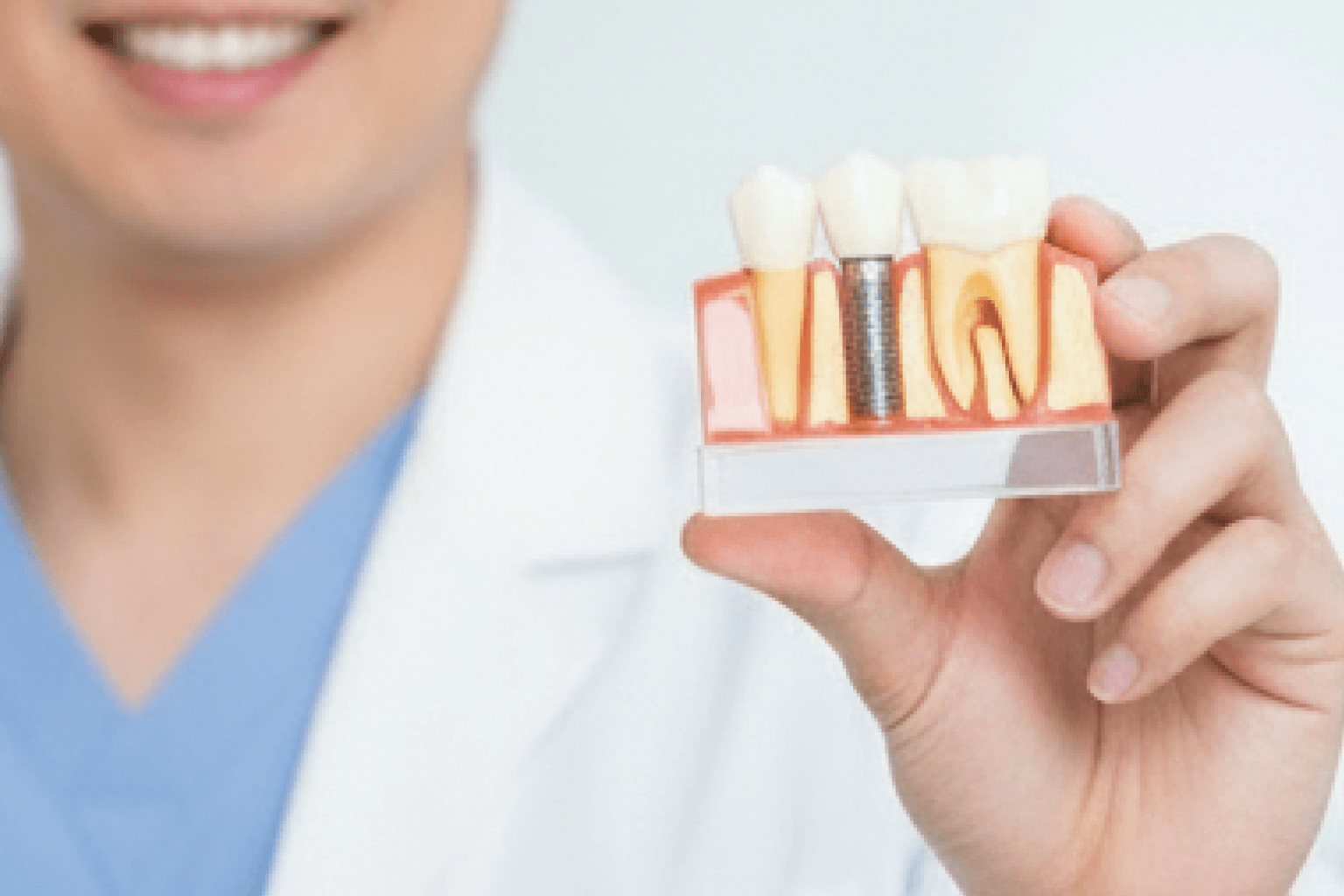 Dental Implants